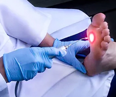 Laserterapia: