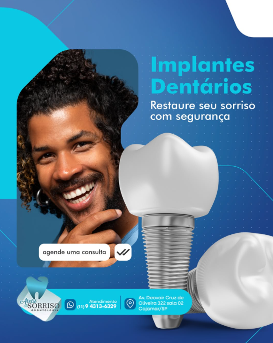 Implante Dentário