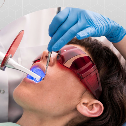 Clareamento Dental